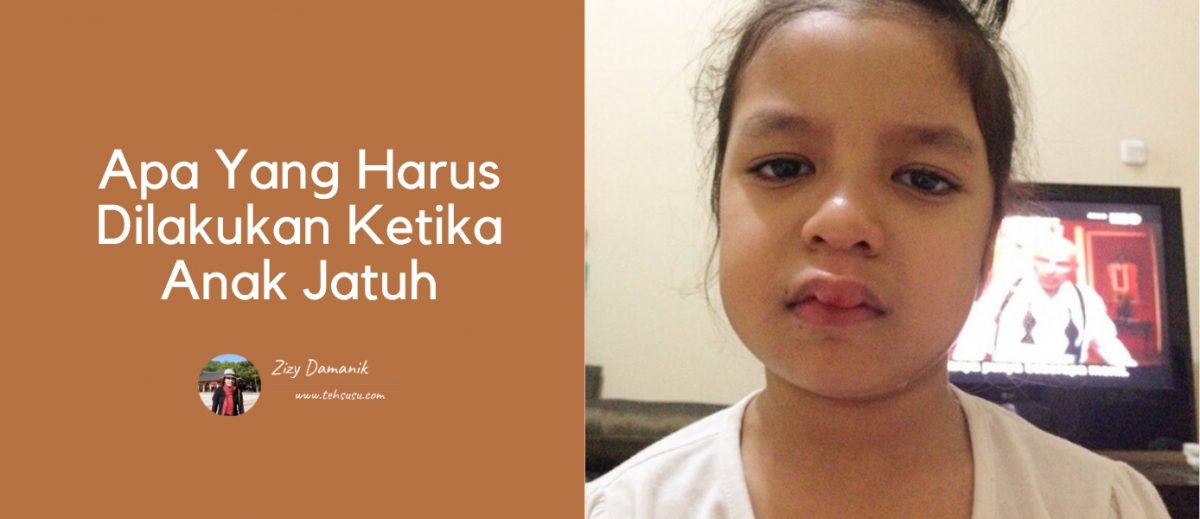 apa yang harus dilakukan ketika anak jatuh