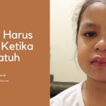 apa yang harus dilakukan ketika anak jatuh