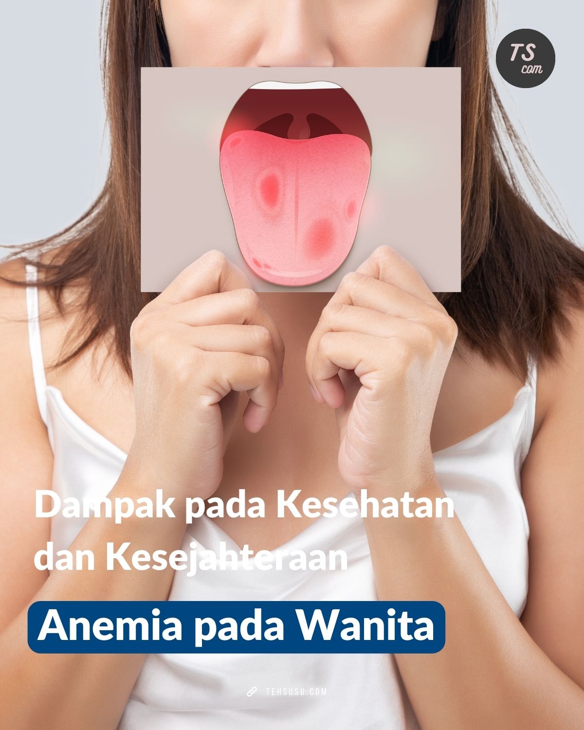 anemia pada wanita